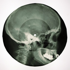 Bone Records, X-Ray Audio,Ribs