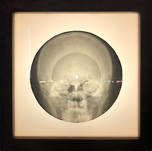 X-Ray Records (1946 - 1964) - Bone Music Exhibition, Villa Heike (Berlin-Hohenschönhausen)